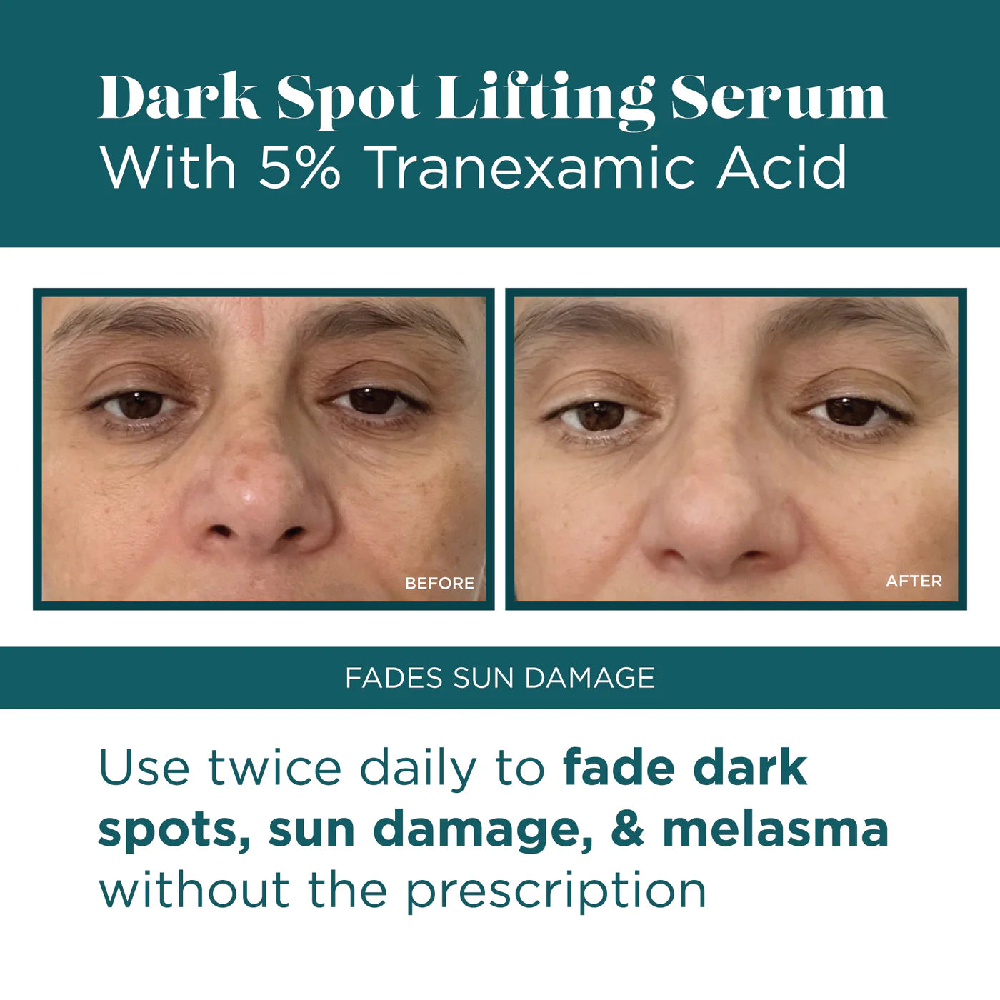 Dark Spot Lifting Serum with % Tranexamic Acid