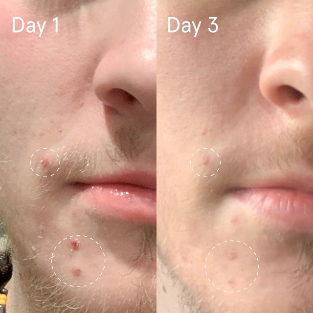 Sulfur Spot Treatment 1.5 oz